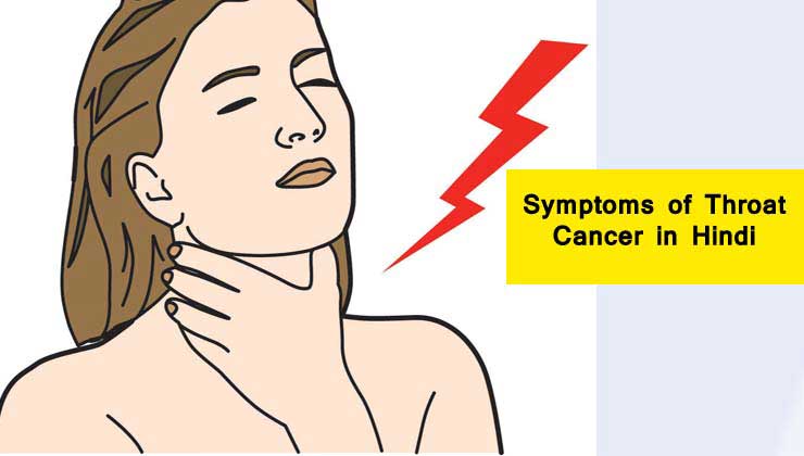 (symptoms of throat cancer)