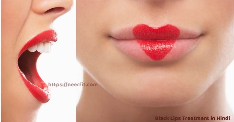 black lips treatment in hindi