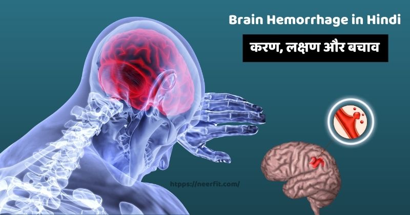 Brain Hemorrhage In Hindi