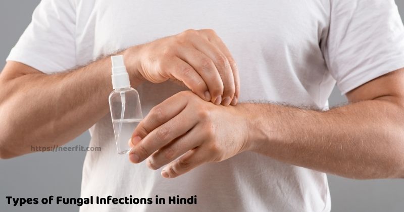Types of Fungal Infections in Hindi